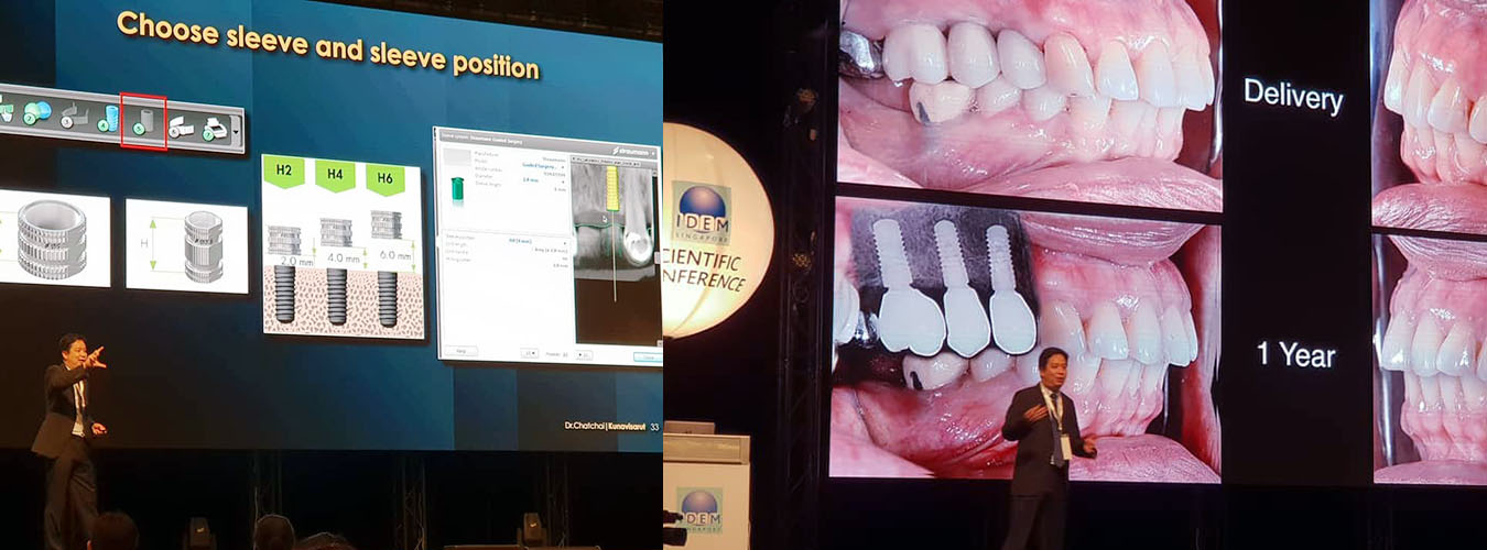 ศูนย์รากเทียม กรุงเทพ